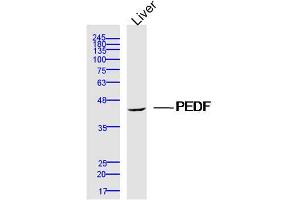 Mouse Liver lysates probed with PEDF Polyclonal Antibody, Unconjugated  at 1:300 dilution and 4˚C overnight incubation.