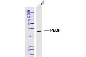 Mouse Liver lysates probed with PEDF Polyclonal Antibody, Unconjugated  at 1:300 dilution and 4˚C overnight incubation. (PEDF 抗体  (AA 101-200))