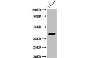 Western Blot Positive WB detected in: Mouse liver tissue All lanes: GNAT1 antibody at 3 μg/mL Secondary Goat polyclonal to rabbit IgG at 1/50000 dilution Predicted band size: 41 kDa Observed band size: 41 kDa (GNAT1 抗体  (AA 92-170))
