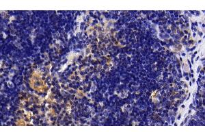 Detection of IL1R1 in Rat Thymus Tissue using Polyclonal Antibody to Interleukin 1 Receptor Type I (IL1R1) (IL1R1 抗体  (AA 226-352))