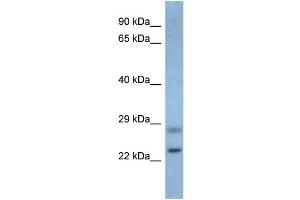 WB Suggested Anti-Neurog3 Antibody Titration: 1. (Neurogenin 3 抗体  (Middle Region))