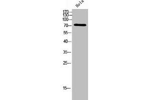 Western Blot analysis of Hela cells using ACSVL6 Polyclonal Antibody (SLC27A5 抗体  (Internal Region))