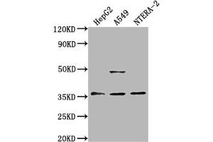 Western Blot Positive WB detected in: HepG2 whole cell lysate, A549 whole cell lysate, NTERA-2 whole cell lysate All lanes: OR4D10 antibody at 1:2000 Secondary Goat polyclonal to rabbit IgG at 1/50000 dilution Predicted band size: 36 kDa Observed band size: 36 kDa (OR4D1 抗体  (AA 86-98))