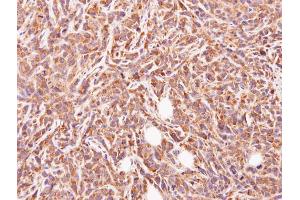 IHC-P Image Immunohistochemical analysis of paraffin-embedded SAS xenograft, using GLYATL1, antibody at 1:500 dilution. (GLYATL1 抗体)