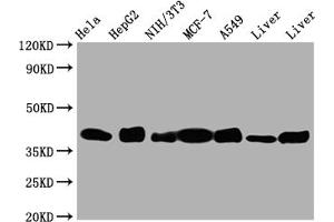 Western Blot Positive WB detected in: Hela whole cell lysate, HepG2 whole cell lysate, NIH/3T3 whole cell lysate, A549 whole cell lysate, Mouse Liver whole cell lysate, Rat Liver whole cell lysate All lanes: Aldolase antibody at 1:1000 Secondary Goat polyclonal to rabbit IgG at 1/50000 dilution Predicted band size: 40, 46 kDa Observed band size: 40 kDa (Recombinant ALDOA 抗体)