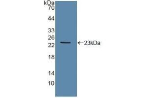 Detection of Recombinant Tie2, Human using Polyclonal Antibody to TEK Tyrosine Kinase, Endothelial (Tie2)
