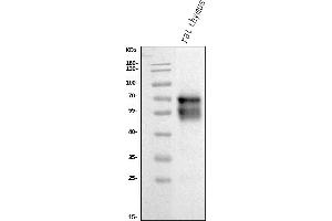 Western blot analysis of CD5 using anti-CD5 antibody (ABIN7600841).