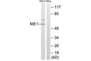 Western blot analysis of extracts from HeLa cells, using ME1 Antibody.