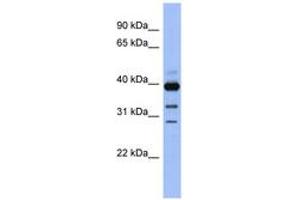 Image no. 1 for anti-Guanine Nucleotide Binding Protein (G Protein), alpha Activating Activity Polypeptide O (GNAO1) (AA 71-120) antibody (ABIN6743833) (GNAO1 抗体  (AA 71-120))