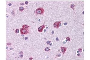 Human Brain, Cortex: Formalin-Fixed, Paraffin-Embedded (FFPE) (MFSD2A 抗体  (C-Term))