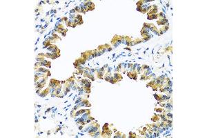 Immunohistochemistry of paraffin-embedded mouse lung using SERPINA10 antibody at dilution of 1:100 (40x lens). (SERPINA10 抗体)