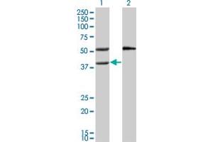 Western Blotting (WB) image for anti-Mevalonate Kinase (MVK) (AA 297-396) antibody (ABIN518109)