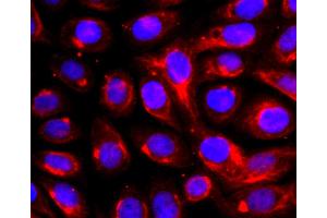 SK-OV-3 cells were fixed with paraformaldehyde, permeabilized with 0. (ADAM17 抗体)