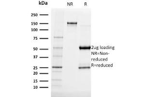 SDS-PAGE Analysis Purified Albumin Mouse Monoclonal Antibody (ALB/2141). (Albumin 抗体)