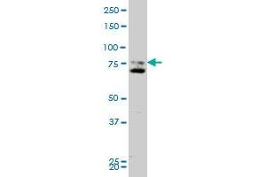 SMO monoclonal antibody (M11), clone 1D9 Western Blot analysis of SMO expression in A-431 . (SMO 抗体  (AA 653-787))