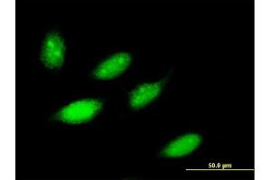 Immunofluorescence of purified MaxPab antibody to ZNF653 on HeLa cell. (ZNF653 抗体  (AA 1-615))