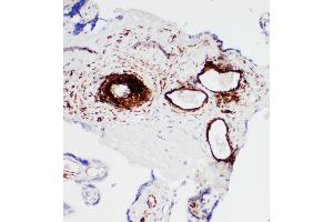 Anti-SERCA1 ATPase antibody, IHC(P) IHC(P): Human Placenta Tissue (ATP2A1/SERCA1 抗体  (Middle Region))