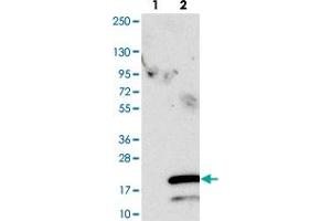 Western blot analysis of Lane 1: Negative control (vector only transfected HEK293T lysate). (SPCS1 抗体)