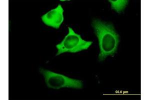 Immunofluorescence of purified MaxPab antibody to FASN on HeLa cell. (Fatty Acid Synthase 抗体  (AA 1-439))