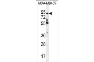ZN Antibody (N-term) (ABIN655412 and ABIN2844957) western blot analysis in MDA-M cell line lysates (35 μg/lane). (ZNF605 抗体  (N-Term))