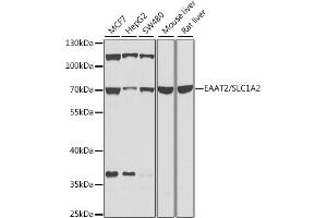 Western blot analysis of extracts of various cell lines, using E/E/SLC1 antibody (ABIN6129469, ABIN6147870, ABIN6147871 and ABIN6214022) at 1:1000 dilution. (SLC1A2 抗体  (AA 495-574))