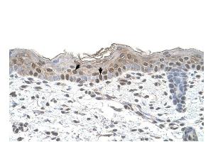 Arrestin B2 antibody was used for immunohistochemistry at a concentration of 4-8 ug/ml to stain Squamous epithelial cells (arrows) in Human Skin. (Arrestin 3 抗体  (Middle Region))