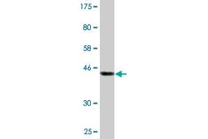 Western Blot detection against Immunogen (45. (ASRGL1 抗体  (AA 1-180))