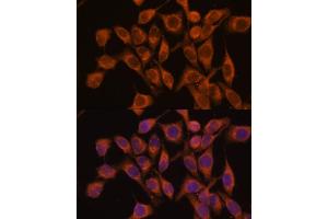 Immunofluorescence analysis of HeLa cells using UBQLNL antibody (ABIN7271125) at dilution of 1:100. (UBQLNL 抗体  (AA 176-475))