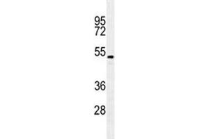 TGFB2 antibody western blot analysis in A549 lysate. (TGFB2 抗体)