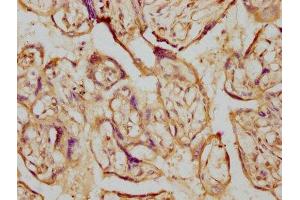 IHC image of ABIN7127445 diluted at 1:230 and staining in paraffin-embedded human placenta tissue performed on a Leica BondTM system. (Recombinant Aromatase 抗体)