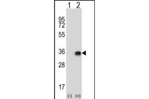 Western blot analysis of CNOT8 (arrow) using rabbit polyclonal CNOT8 Antibody (N-term) (ABIN656816 and ABIN2846030). (CNOT8 抗体  (N-Term))