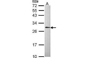 WB Image Sample (30 ug of whole cell lysate) A: Hep G2 , 12% SDS PAGE antibody diluted at 1:1000 (DCXR 抗体  (C-Term))