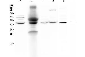 Western blot analysis of NCF1 using anti-NCF1 antibody .