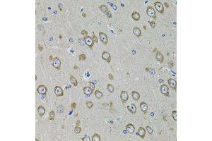 Immunohistochemistry of paraffin-embedded rat brain using PDE1B antibody. (PDE1B 抗体  (AA 190-536))