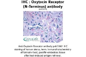 Image no. 1 for anti-Oxytocin Receptor (OXTR) (Extracellular Domain), (N-Term) antibody (ABIN1737739) (Oxytocin Receptor 抗体  (Extracellular Domain, N-Term))