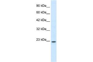 WB Suggested Anti-HOXB6 Antibody Titration: 0. (HOXB6 抗体  (N-Term))