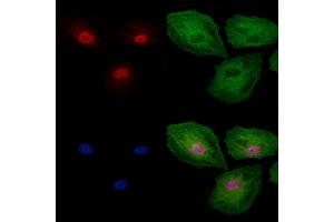 Phospho-Gli2 (Ser149) Antibody staining A549 cells(4h of LPS treatment) by IF/ICC. (GLI2 抗体  (pSer149))