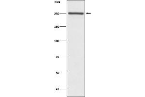 Western blot analysis of NOTCH4 expression in Mouse lung lysate.