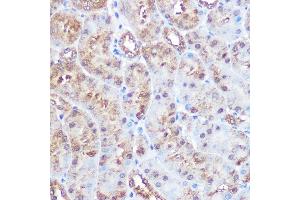 Immunohistochemistry of paraffin-embedded mouse kidney using ERK5 Rabbit mAb (ABIN1680723, ABIN3018327, ABIN3018328 and ABIN7101595) at dilution of 1:100 (40x lens). (MAPK7 抗体)