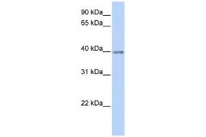 Opticin antibody used at 1 ug/ml to detect target protein.