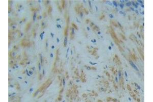 Detection of TNFR1 in Human Prostate Tissue using Polyclonal Antibody to Tumor Necrosis Factor Receptor 1 (TNFR1)