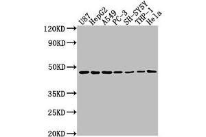 Western Blot Positive WB detected in: U87 whole cell lysate, HepG2 whole cell lysate, A549 whole cell lysate, PC-3 whole cell lysate, SH-SY5Y whole cell lysate, THP-1 whole cell lysate, Hela whole cell lysate All lanes: NDRG1 antibody at 1:2000 Secondary Goat polyclonal to rabbit IgG at 1/50000 dilution Predicted band size: 43, 36, 34 kDa Observed band size: 43 kDa (NDRG1 抗体  (AA 136-394))