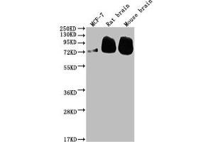 Western Blot Positive WB detected in: MCF-7 whole cell lysate, Rat brain tissue, Mouse brain tissue All lanes: BACE1 antibody at 1:2000 Secondary Goat polyclonal to rabbit IgG at 1/50000 dilution Predicted band size: 56, 53, 52, 49, 46, 43 kDa Observed band size: 72 kDa (Recombinant BACE1 抗体)
