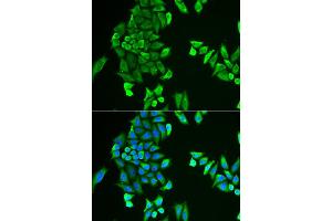 Immunofluorescence analysis of HeLa cell using ACSS2 antibody. (ACSS2 抗体)
