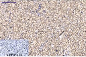 Immunohistochemical analysis of paraffin-embedded mouse kidney tissue. (AMACR 抗体)