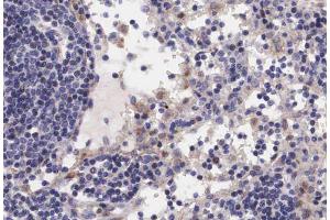 Immunohistochemistry (IHC) image for anti-V-Raf-1 Murine Leukemia Viral Oncogene Homolog 1 (RAF1) (pSer621) antibody (ABIN6256385)