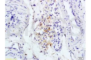 Immunohistochemistry (IHC) image for anti-Interleukin 1 Receptor, Type I (IL1R1) (AA 481-569) antibody (ABIN747743)