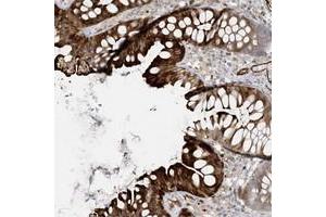 Immunohistochemical staining of human colon with BCORL1 polyclonal antibody  shows strong cytoplasmic and membranous positivity in glandular cells. (BCORL1 抗体)