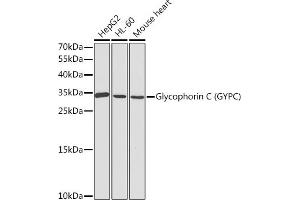 Western blot analysis of extracts of various cell lines, using Glycophorin C (Glycophorin C (GYPC)) antibody (ABIN3021795, ABIN3021796, ABIN3021797 and ABIN6215928) at 1:1000 dilution. (CD236/GYPC 抗体  (AA 1-128))