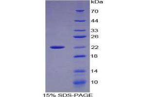 SDS-PAGE analysis of Cow Matrix Metalloproteinase 9 (MMP9) Protein. (MMP 9 蛋白)
